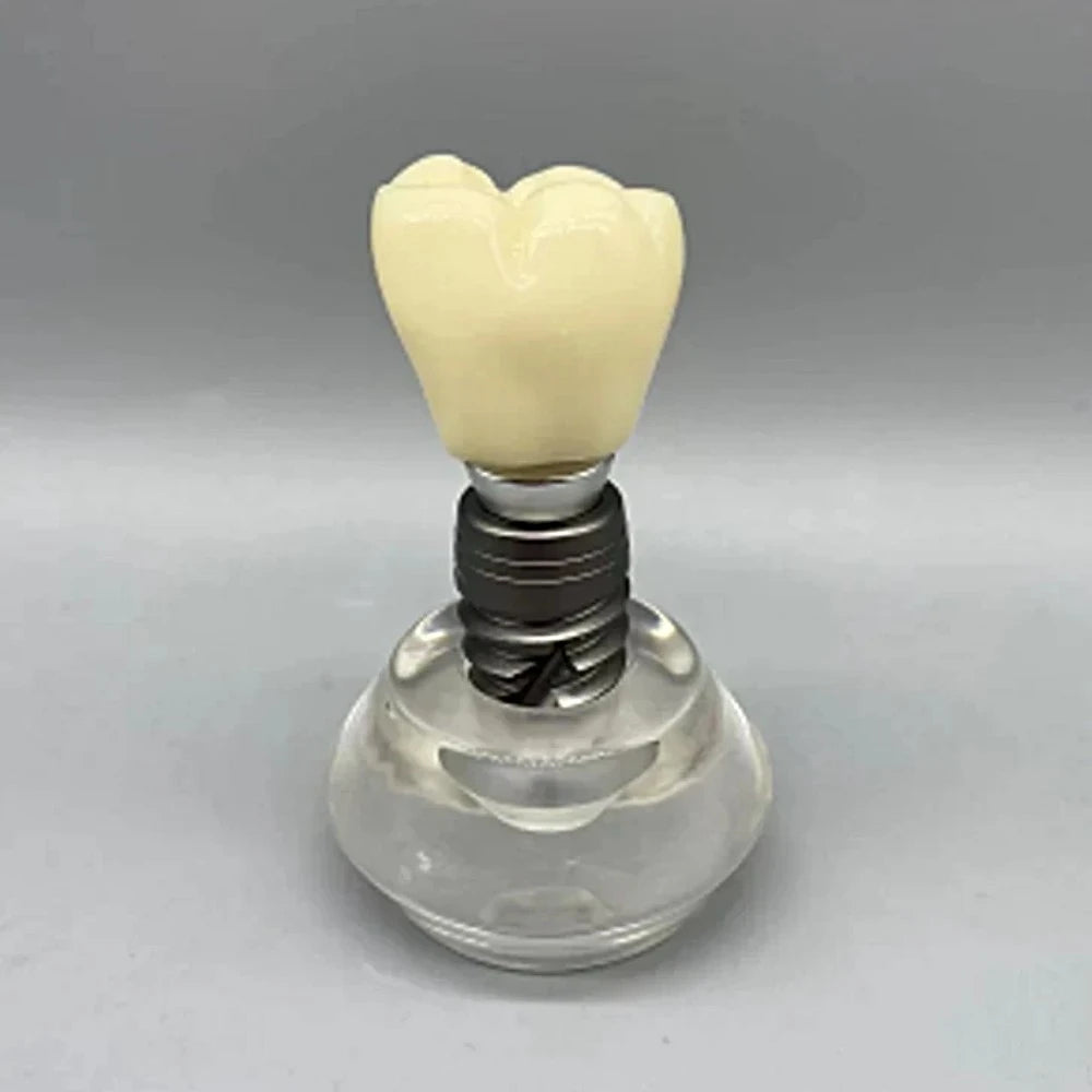 Dental Implant Educational Model - Dental Mates