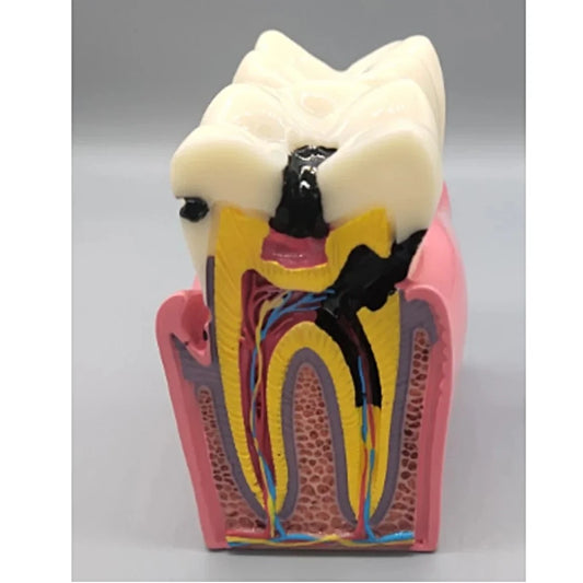 Double Teeth Model - Dental Mates