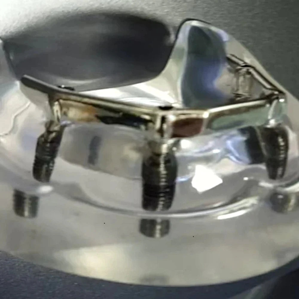 Dental Implant Bar - Dental Mates