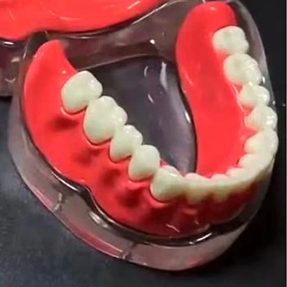 Implant Model Full Mouth Denture Mandible or Maxilla - Dental Mates