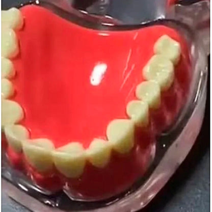 Implant Model Full Mouth Denture Mandible or Maxilla - Dental Mates
