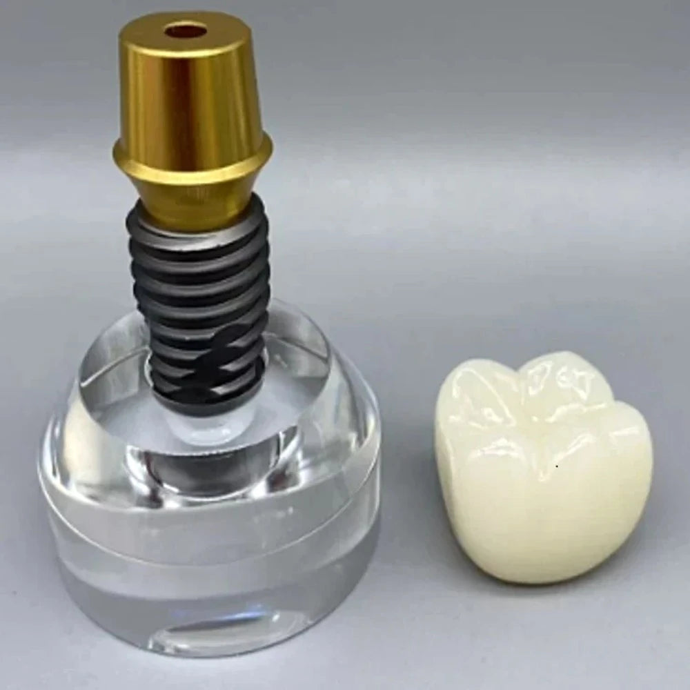 Double Teeth Model - Dental Mates